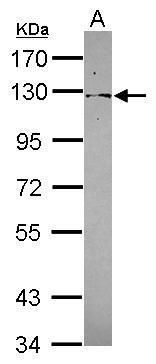 Western blot analysis of PSD4 using 30µg of A431 lysate. Samples were loaded onto a 7.5% SDS-PAGE gel and probed with a PSD4 polyclonal antibody (Product # PA5-31837) at a dilution of 1:1000.