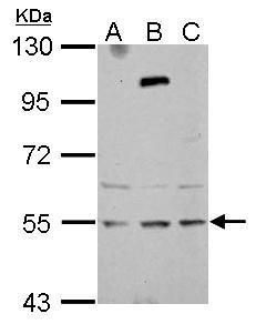 Western blot analysis of ZNF513 using 30µg of A) NT2D1 (B) U87-MG and C) SK-N-SH lysate. Samples were loaded onto a 7.5% SDS-PAGE gel and probed with a ZNF513 polyclonal antibody (Product # PA5-31985) at a dilution of 1:1000.