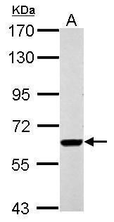 Western blot analysis of RUNDC1 using 30µg of HepG2 lysate. Samples were loaded onto a 7.5% SDS-PAGE gel and probed with a RUNDC1 polyclonal antibody (Product # PA5-31987) at a dilution of 1:500.