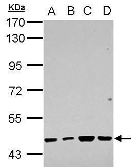 Western blot analysis of RBMY1F using 30µg of A) NT2D1 (B) PC-3 (C) U87-MG and D) SK-N-SH lysate. Samples were loaded onto a 7.5% SDS-PAGE gel and probed with a RBMY1F polyclonal antibody (Product # PA5-32067) at a dilution of 1:5000.