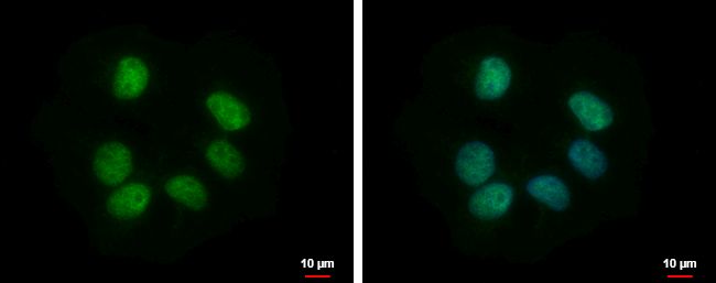 Immunofluorescent analysis of RBMY1F showing staining in the nucleus of NT2D1 cells. NT2D1 cells were fixed in 4% paraformaldehyde at RT for 15 min and stained using a RBMY1F polyclonal antibody (Product # PA5-32067) diluted at 1:500. Blue: Hoechst 33342 staining. Scale bar = 10 ?m.