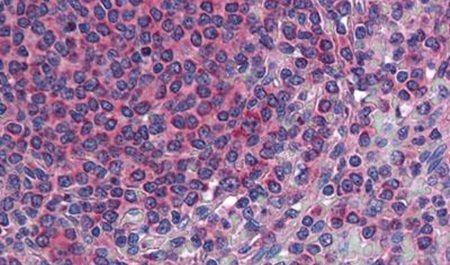 Immunohistochemical analysis of formalin-fixed paraffin-embedded human spleen using a TM9SF3 polyclonal antibody (Product # PA5-33078). Heat-induced antigen retrieval was performed prior to staining.