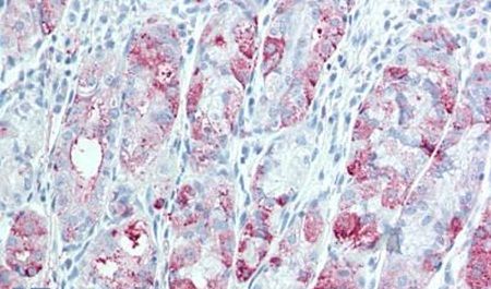 Immunohistochemical analysis of formalin-fixed paraffin-embedded human stomach using a TSPAN13 polyclonal antibody (Product # PA5-33092). Heat-induced antigen retrieval was performed prior to staining.
