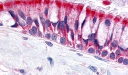 Immunohistochemical analysis of formalin-fixed paraffin-embedded human nasal mucosa, respiratory epithelium using a OR6N1 polyclonal antibody (Product # PA5-34058). Heat-induced antigen retrieval was performed prior to staining.