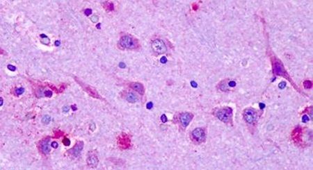 Immunohistochemical analysis of formalin-fixed paraffin-embedded human brain, cortex, neurons using a OR6N1 polyclonal antibody (Product # PA5-34059) at a 6-14 ug/ml dilution. Heat-induced antigen retrieval was performed prior to staining.