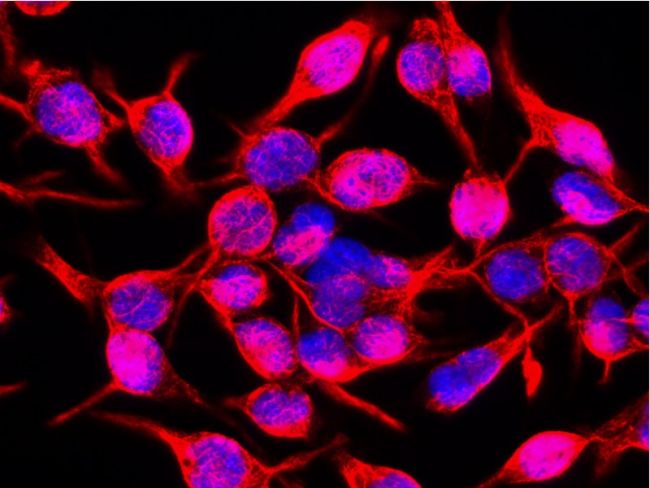 Immunofluorescence staining of RBL rat basophilic cell line with anti-Vimentin (VI-10). Nuclei are stained with DAPI (blue).