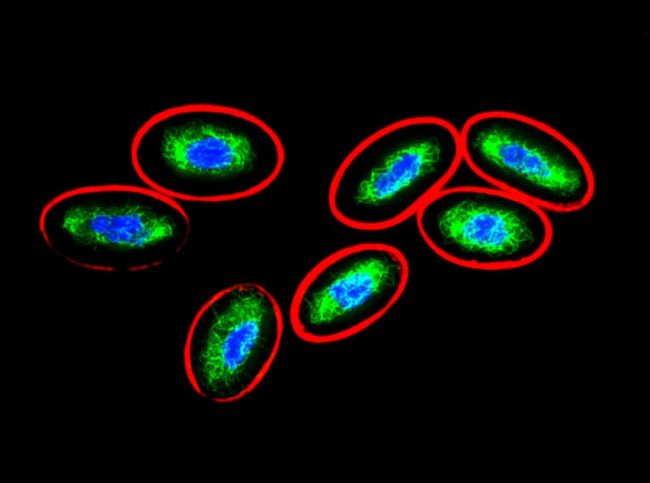 Immunofluorescence staining of chicken postnatal erythrocytes. Tubulin (red) was stained with anti-alpha-tubulin (TU-01), vimentin (green) with anti-Vimentin (VI-10). Nuclei are stained with DAPI (blue).
