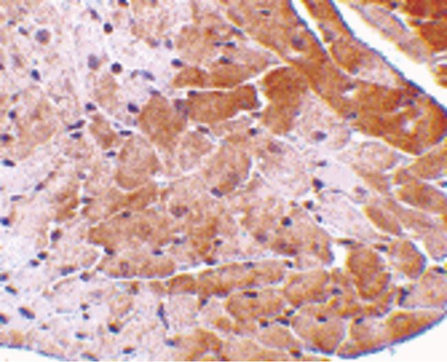 Immunohistochemical staining of mouse heart tissue using a CIDE-A polyclonal antibody (Product # PA5-19908) at a 5 ug/mL dilution.