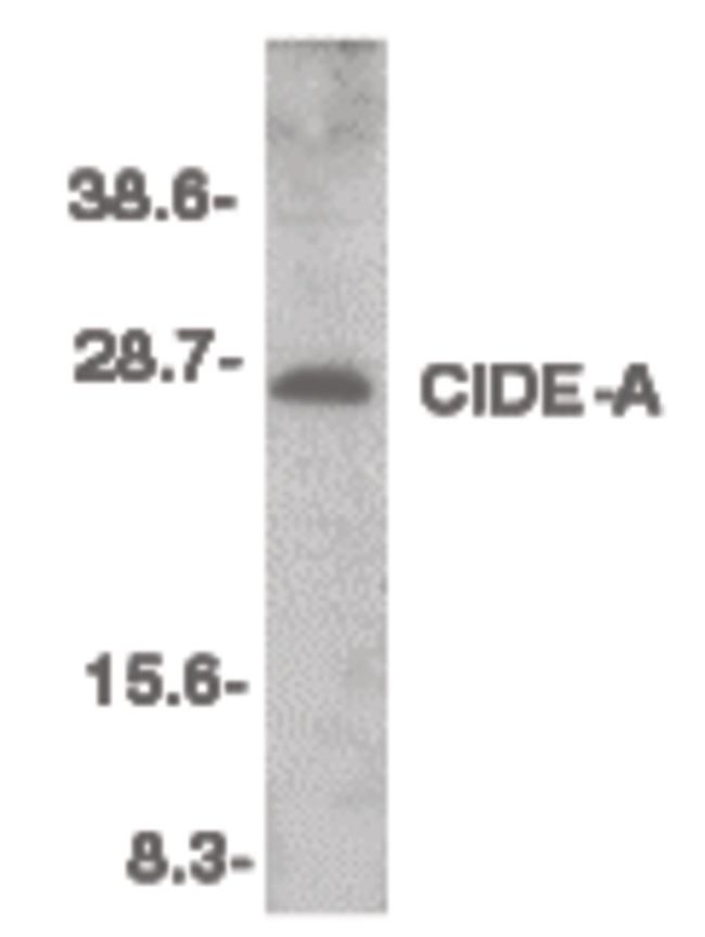 Western blot analysis of mouse heart tissue lysate using a CIDE-A polyclonal antibody (Product # PA5-19908) at 1:500 dilution.