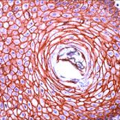 Formalin-fixed, paraffin-embedded human skin stained with Cadherin pan antibody using peroxidase-conjugate and AEC. Note membrane staining of epithelial cells