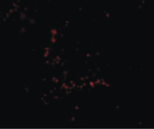 Immunofluorescent analysis of human ovary cells using a TRIM30 polyclonal antibody (Product # PA5-20590) at a 20 ug/mL dilution.