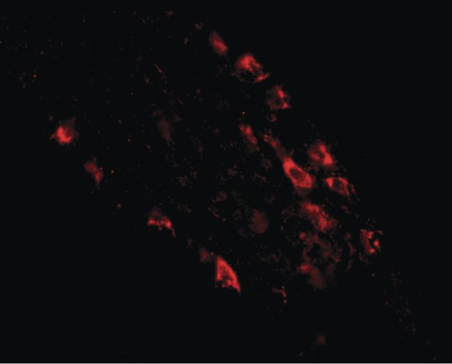 Immunofluorescent analysis of human small intestine tissue using a Rkhd1 polyclonal antibody (Product # PA5-20621) at a 20 ug/mL dilution.