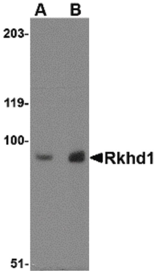 Western blot analysis of MDA-MB-361 cell lysate using a Rkhd1 polyclonal antibody (Product # PA5-20621) at (A) 1 ug/ml and (B) 2 ug/mL.