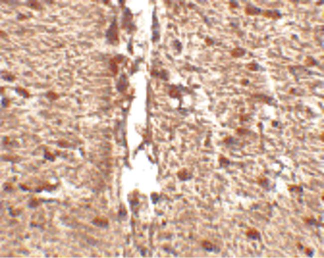 Immunohistochemical staining of human small intestine tissue using a Rkhd1 polyclonal antibody (Product # PA5-20621) at a 25 ug/mL dilution.