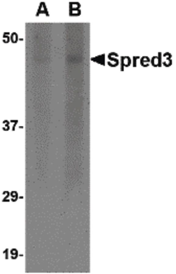 Western blot analysis of human brain tissue lysate using a Spred3 polyclonal antibody (Product # PA5-20626) at (A) 2 and (B) 4 ug/mL.