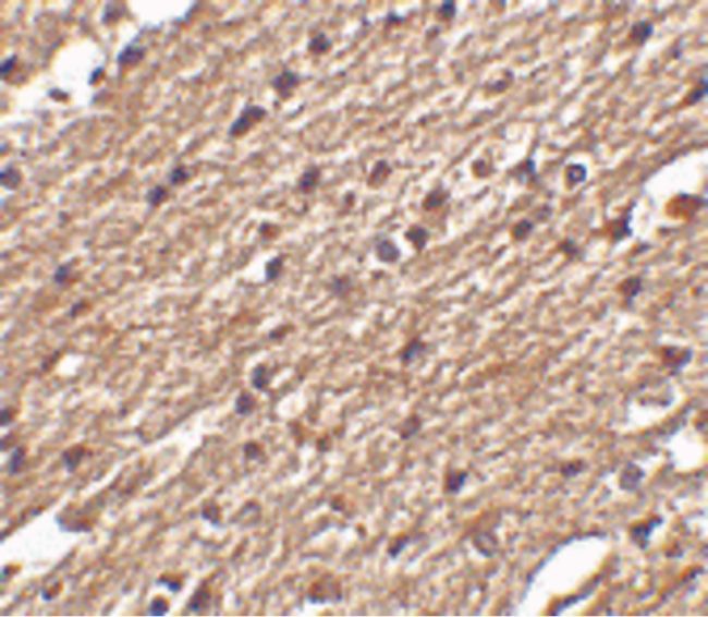 Immunohistochemical staining of human brain tissue using a Spred3 polyclonal antibody (Product # PA5-20626) at a 25 ug/mL dilution.