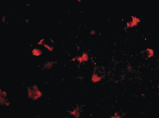 Immunofluorescent analysis of human brain tissue using a Rkhd4 polyclonal antibody (Product # PA5-20639) at a 20 ug/mL dilution.