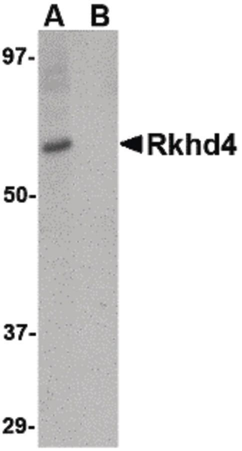 Western blot analysis of SK-N-SH cell lysate using a Rkhd4 polyclonal antibody (Product # PA5-20639) at 1 ug/mL in either (A) the presence and (B) the absence of blocking peptide.