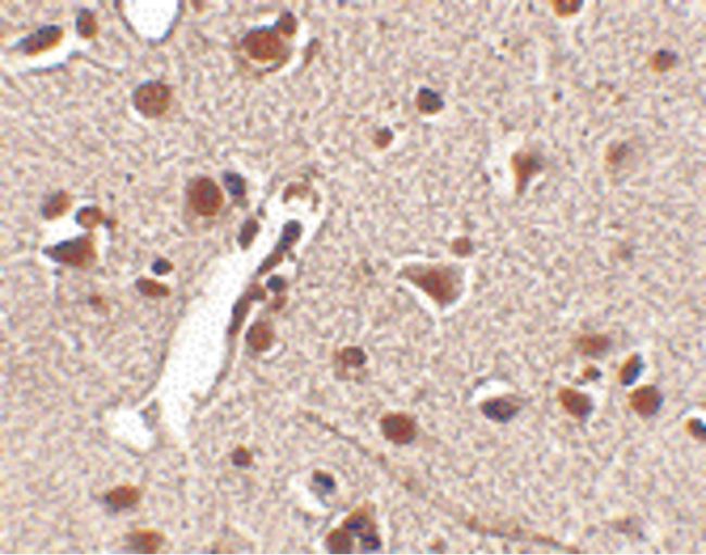 Immunohistochemical staining of human brain tissue using a Rkhd4 polyclonal antibody (Product # PA5-20639) at a 25 ug/mL dilution.