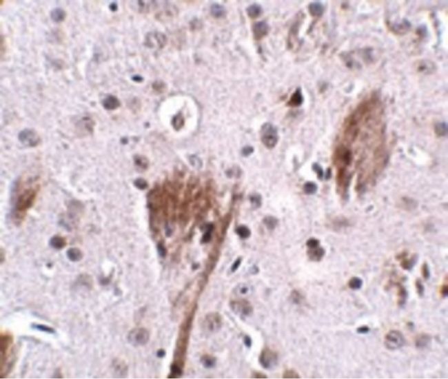 Immunohistochemical staining of mouse brain tissue using a SPG11 polyclonal antibody (Product # PA5-20683) at a 25 ug/mL dilution.