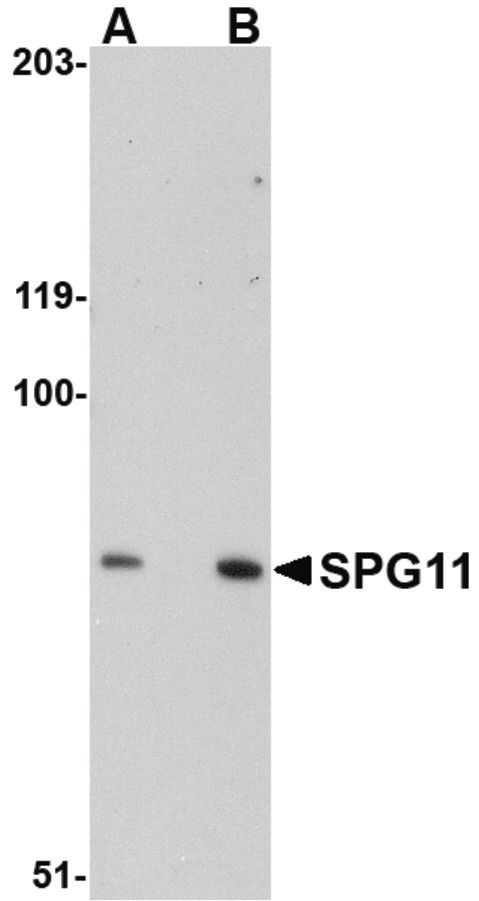 Western blot analysis of mouse heart tissue lysate using a SPG11 polyclonal antibody (Product # PA5-20683) at (A) 0.5 and (B) 1 ug/mL.