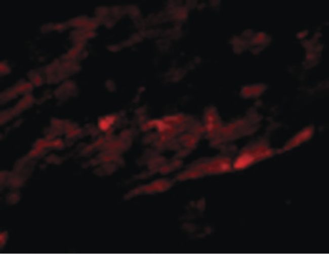 Immunofluorescent analysis of mouse heart cells using a SPG15 polyclonal antibody (Product # PA5-20685) at a 20 ug/mL dilution.