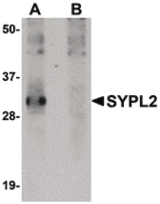 Western blot analysis of human spleen tissue lysate using a SYPL2 polyclonal antibody (Product # PA5-20776) at 1 ug/mL in either (A) the presence and (B) the absence of blocking peptide.