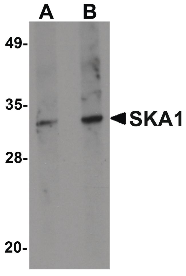 Western blot analysis of A549 cell lysate using a SKA1 polyclonal antibody (Product # PA5-20817) at (A) 0.5 and (B) 1 ug/mL.