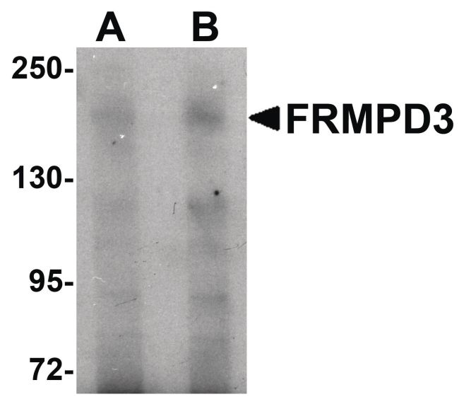 Western blot analysis of Jurkat cell lysate using a FRMPD3 polyclonal antibody (Product # PA5-20840) at (A) 1 and (B) 2 ug/mL.