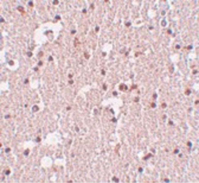 Immunohistochemical staining of human brain tissue using a FRMPD3 polyclonal antibody (Product # PA5-20840) at a 5 ug/mL dilution.