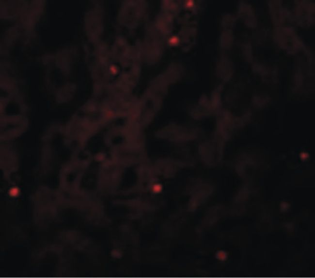Immunofluorescent analysis of human liver cells using a FAM59A polyclonal antibody (Product # PA5-20845) at a 20 ug/mL dilution.