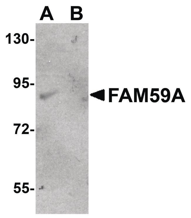 Western blot analysis of rat liver tissue lysate using a FAM59A polyclonal antibody (Product # PA5-20845) at 1 ug/mL in either (A) the presence and (B) the absence of blocking peptide.