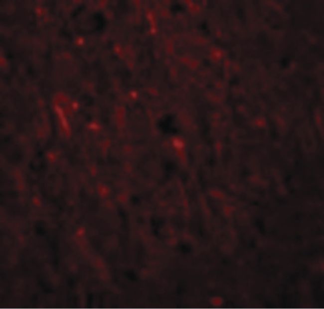 Immunofluorescent analysis of human brain cells using a PLEKHM2 polyclonal antibody (Product # PA5-20850) at a 20 ug/mL dilution.