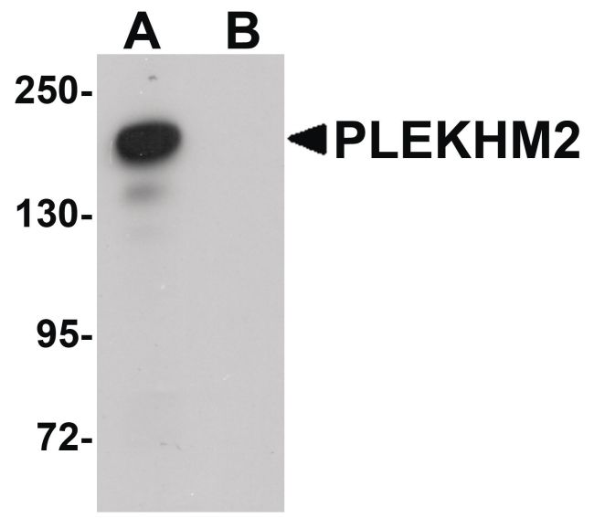 Western blot analysis of rat brain tissue lysate using a PLEKHM2 polyclonal antibody (Product # PA5-20850) at 0.5 ug/mL in either (A) the presence and (B) the absence of blocking peptide.