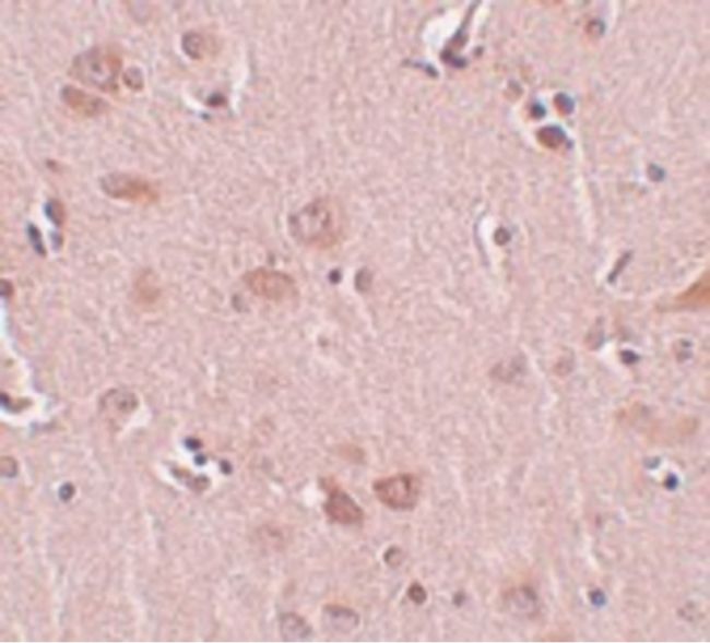 Immunohistochemical staining of human liver tissue using a PLEKHM2 polyclonal antibody (Product # PA5-20850) at a 5 ug/mL dilution.
