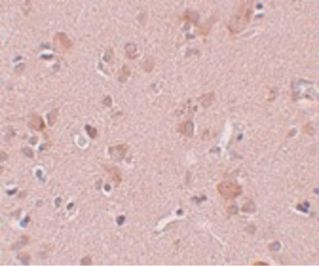 Immunohistochemical staining of human brain tissue using a PLEKHM3 polyclonal antibody (Product # PA5-20851) at a 5 ug/mL dilution.