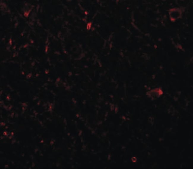 Immunofluorescent analysis of human brain tissue using a PLEKHM3 polyclonal antibody (Product # PA5-20851) at a 20 ug/mL dilution.