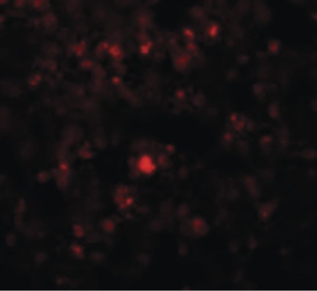 Immunofluorescent analysis of rat lung cells using a RHBDD2 polyclonal antibody (Product # PA5-20861) at a 20 ug/mL dilution.