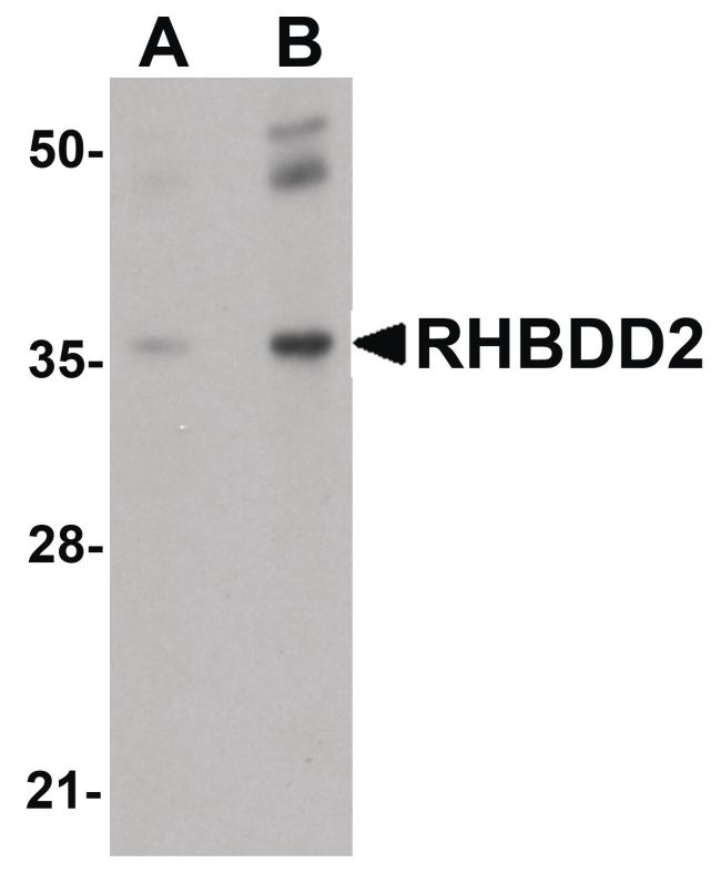 Western blot analysis of rat lung tissue lysate using a RHBDD2 polyclonal antibody (Product # PA5-20861) at (A) 1 and (B) 2 ug/mL.