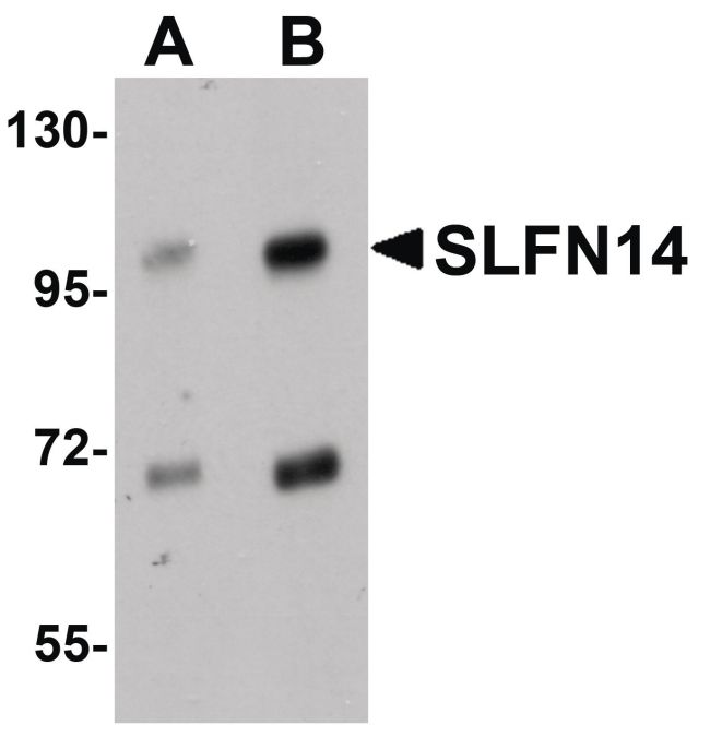 Western blot analysis of mouse kidney tissue lysate using a SLFN14 polyclonal antibody (Product # PA5-20868) at (A) 1 and (B) 2 ug/mL.