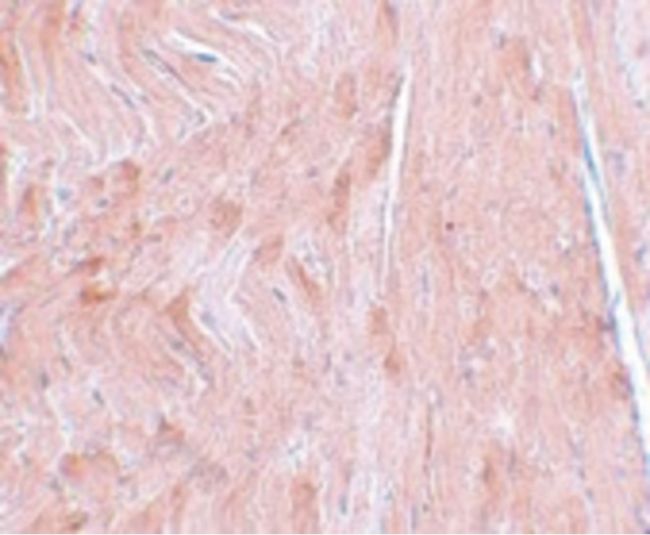 Immunohistochemical staining of mouse heart tissue using a REEP3 polyclonal antibody (Product # PA5-20884) at a 5 ug/mL dilution.