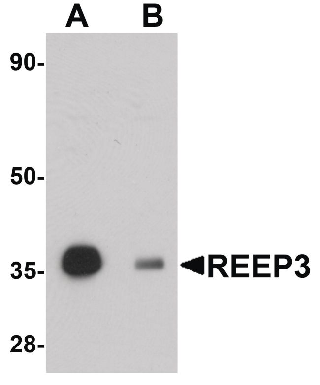 Western blot analysis of rat heart tissue lysate using a REEP3 polyclonal antibody (Product # PA5-20884) at 1 ug/mL in either (A) the presence and (B) the absence of blocking peptide.
