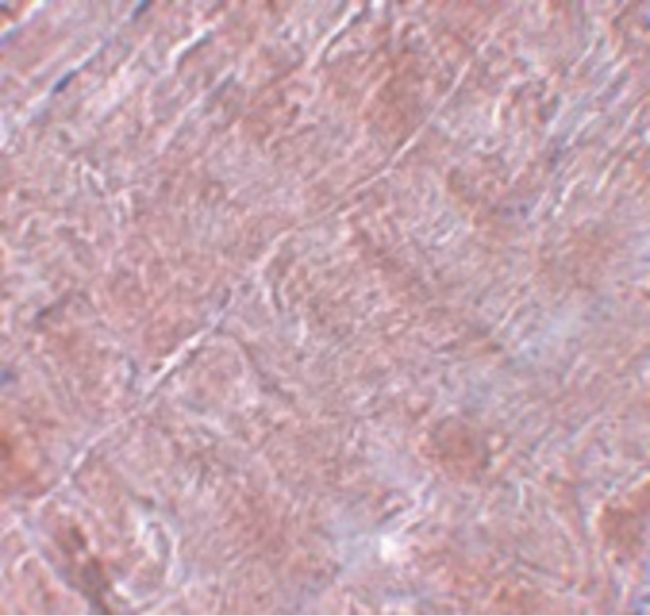 Immunohistochemical staining of human skeletal muscle tissue using a RANBP10 polyclonal antibody (Product # PA5-20930) at a 5 ug/mL dilution.