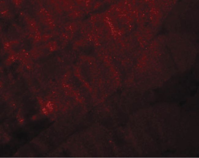 Immunofluorescent analysis of mouse skeletal muscle tissue using a RANBP10 polyclonal antibody (Product # PA5-20930) at a 20 ug/mL dilution.