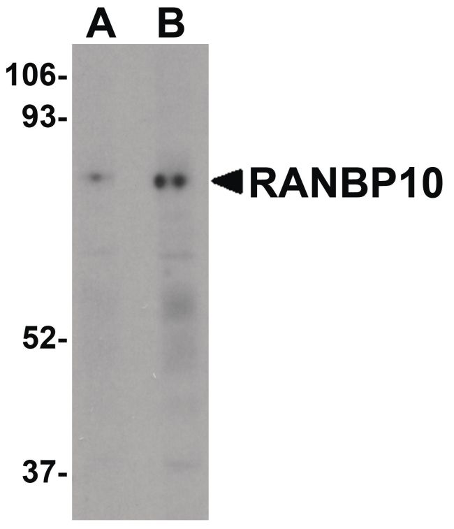 Western blot analysis of human skeletal muscle tissue lysate using a RANBP10 polyclonal antibody (Product # PA5-20930) at (A) 1 and (B) 2 ug/mL.