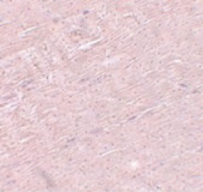 Immunohistochemical staining of mouse skeletal muscle tissue using a ADAMTSL5 polyclonal antibody (Product # PA5-20934) at a 5 ug/mL dilution.