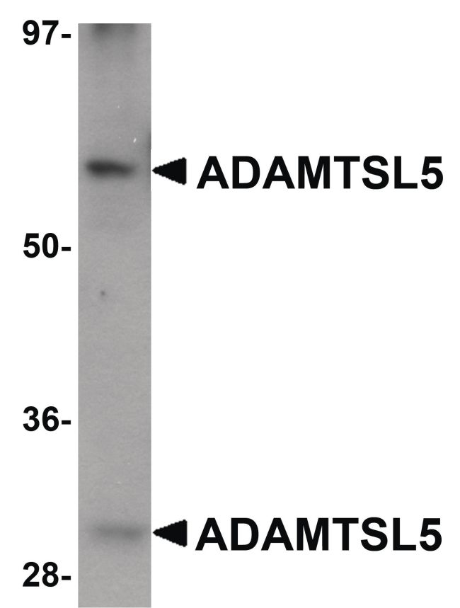 Western blot analysis of human skeletal muscle tissue lysate using a ADAMTSL5 polyclonal antibody (Product # PA5-20934) at 1 ug/mL.
