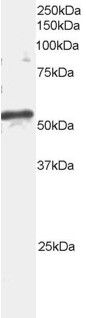 Western Blot staining of Mouse brain extracts using PA5-17979 at a concentration of 2 ug/ml, the primary antibody incubation was 1 hour and the detection method was chemiluminescence.
