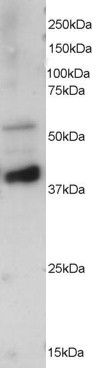 Western Blot staining of Mouse brain extracts using PA5-17981 at a concentration of 0.5 ug/ml, the primary antibody incubation was 1 hour and the detection method was chemiluminescence.