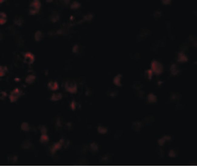 Immunofluorescent analysis of Daudi cells using a SCUBE1 polyclonal antibody (Product # PA5-20990) at a 20 ug/mL dilution.
